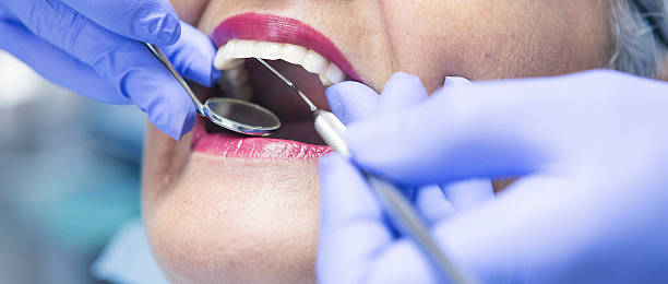 Best Emergency Tooth Extraction in Galva, IL